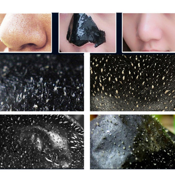 Charcoal Black Heads Remover
